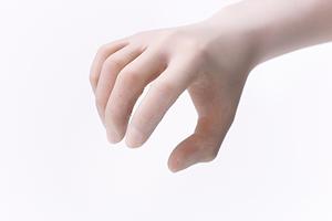 すきっ歯の悩みにも応える矯正治療