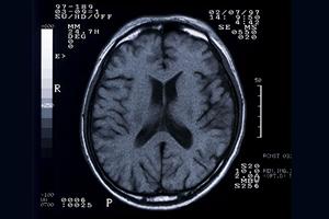 一宮市で高血圧の治療ができるクリニック